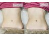 NR機器【筋膜リリース】９０分機械全身・筋膜リリースマッサージ￥13,980
