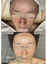 サロンノワ(salon noix)/《お肌はモチベーション》