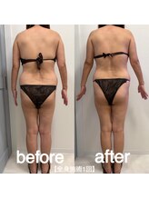 エラ(Ella)/■お客様ビフォーアフター■