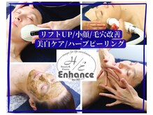 エンハンス(Enhance)