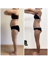 ヨサパーク ディアナ(YOSA PARK Diana)/ビフォーアフター