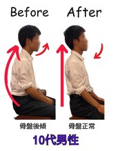 るい鍼灸整骨院/姿勢矯正