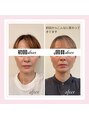 ル フラーズ(Les Fleurs) 小顔矯正/小顔/肩こり/ヘッドスパ/リンパマッサージ/福岡市
