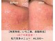アクシア ビューティー サロン(AXSIA)の写真/いちご鼻や毛穴のザラツキをケアして美肌を目指しメイクのりUPをサポート☆