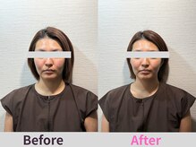 ケンビ(Kenbi)の雰囲気（美容鍼×整体・美容鍼×小顔矯正だからこその即効性＆持続性♪）