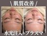 小顔×肌質改善★ノンニードル水光注入+プラズマシャワー¥6600★