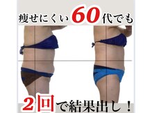 ハイパーナイフダイエット（全身２回の施術です）