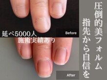 自爪ケア専門サロン イニュラ(inula)
