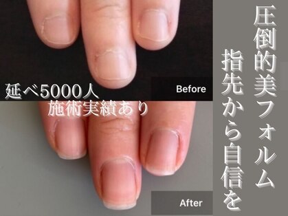 自爪ケア専門サロン イニュラ(inula)の写真
