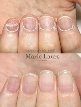 マリーロール 天王寺店(Marie Laure)/深爪矯正/自爪育成/ネイルケア