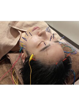 小顔になりたい