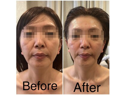 ケイビューティーサロン(K BeautySalon)の写真