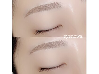 アイノワ 伏石駅前(eyenowa.)の写真