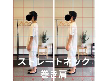 カワル整体 長嶺院/ストレートネック