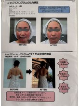 ジュンギンザ(JUN GINZA)/小顔