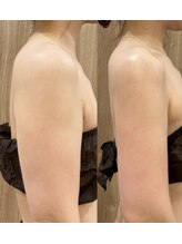 インディバエステサロン ソレイユ/