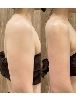 インディバエステサロン ソレイユ/