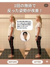 のなか整体院/整体 Before→After