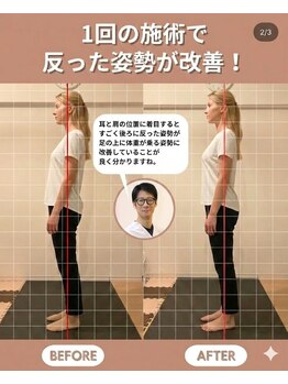 のなか整体院/整体 Before→After