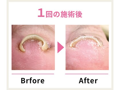 名古屋駅前巻き爪センターの写真