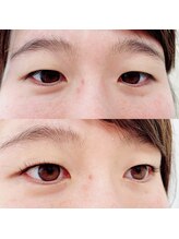 ルピナス(Lupinus)/ラッシュリフト