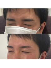 眉毛の王様 神戸三宮店/お客様の施術例【神戸/三ノ宮】