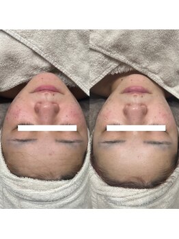 インク(ink)/【赤み軽減/トーンUP】