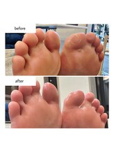 ケアプラス(care plus)/足裏角質ケア