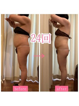 キュール(KuhL)/40代痩身ビフォーアフター☆