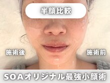 韓国肌管理室 ソア(soa)の雰囲気（本物志向の小顔＆肌管理｜肌が変われば人生も変わる♪）