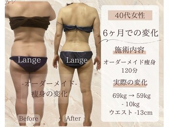 サロン ド ボーテ ラーンジュ 岐阜店(salon de beaut'e L'ange)/ハイパ-ナイフEX2ダイエット痩身