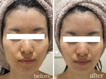 ピュウリリアーナ(PIU LILIANA)/