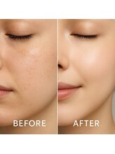 fallon beauty　痩身/フェイシャル/フェム・オムケア/アロマ/ボディケア/フェイシャルエイン毛穴ケア