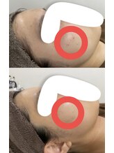 フォルチェ 三川町(Folche)/《フェイシャル》