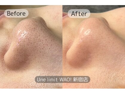 アンリミットワオ(Unelimit WAO!)の写真