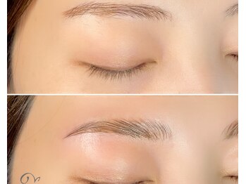 ヴィータ(VITA)/ハリウッドブロウリフト