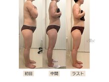 エルベ(ellbe)の雰囲気（2ヶ月集中痩身プログラムで大幅サイズダウン★浮腫み、歪み解消）