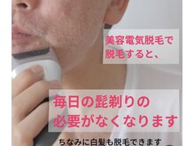 アールプラスラボ(R+labo)/美容電気脱毛の魅力！