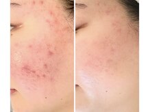 スリリアン 銀座/★お客さまビフォーアフター★