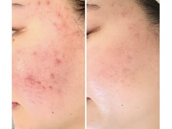 スリリアン 銀座/★お客さまビフォーアフター★