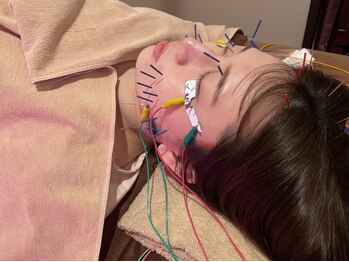 世田谷ビューティークリニークの写真/【デスクワークで目や首・肩の疲れが気になる方】マッサージで届かない深層からアプローチし根本改善が叶う