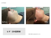 フェレザ 新潟(Felleza)/マスク蒸れ対策にも◎