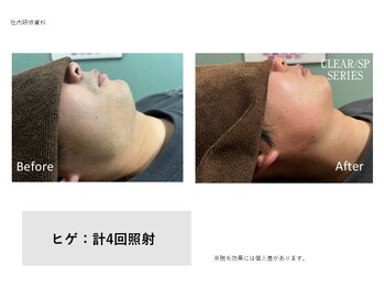 フェレザ 新潟(Felleza)/マスク蒸れ対策にも◎