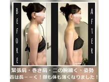 蒼(so)/1回で変わる！骨格別痩身