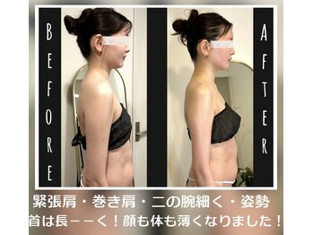 蒼(so)/1回で変わる!骨格別痩身