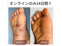 【根本改善】施術・来店不要オンラインのみ！改善レベルが圧倒的