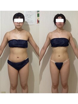 ウツク(utuku)/筋膜リリース脂肪分解燃焼　EMS