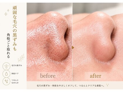イニジアエリート 池袋店(inizia elite)の写真