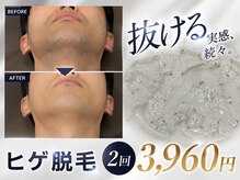 メンズテラス(MEN'S TERAS)の雰囲気(メンズヒゲ脱毛が2回で3960円♪ただいまキャンペーン中☆)
