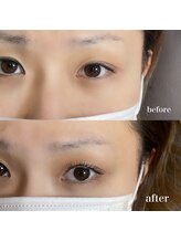 ロミー 新宿(romy.)/ケラチンラッシュリフト